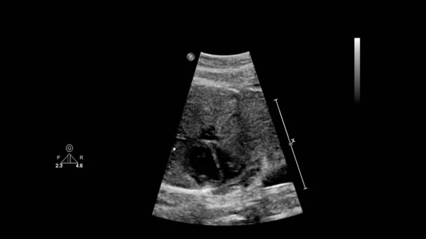 Ultrasound screen with fetal echocardiography. — Stock Photo, Image