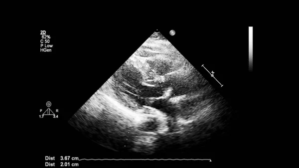 Transesofageal Ultrason Sırasında Kalbin Gri Ölçekli Görüntüsü — Stok fotoğraf