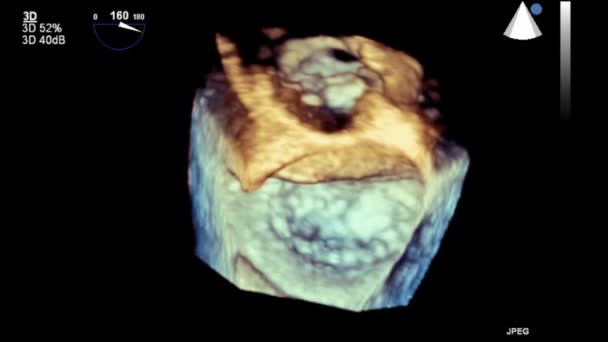 Transesophageal Ultrasound Video Mode — Stok video