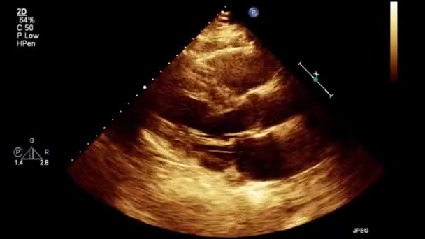 Transesophageal Ultrasound Video Gray Scale Mode — Stok video