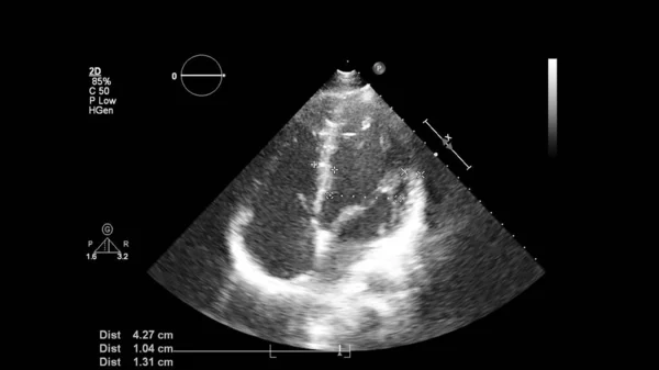 Transesofageal Ultrason Sırasında Kalbin Gri Ölçekli Görüntüsü — Stok fotoğraf