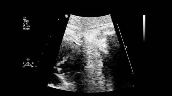 Echografie Scherm Met Foetale Echocardiografie — Stockfoto