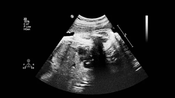 Fetal Ekokardiyografi Ile Ultrasonografi Ekranı — Stok fotoğraf