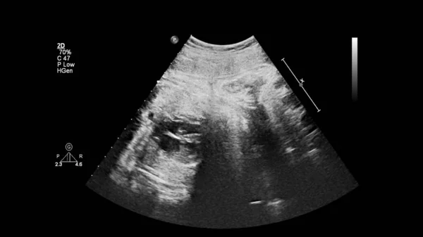 Ecrã Ultrassonográfico Com Ecocardiografia Fetal — Fotografia de Stock