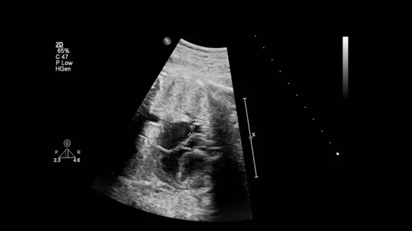 Echografie Scherm Met Foetale Echocardiografie — Stockfoto