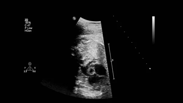 Echografie Scherm Met Foetale Echocardiografie — Stockfoto