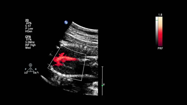 Ultrazvuková Obrazovka Fetální Echokardiografií — Stock fotografie