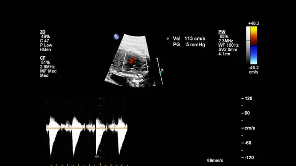 Ecografía Con Ecocardiografía Fetal —  Fotos de Stock