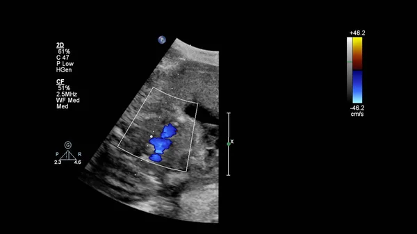 Layar Ultrasound Dengan Echocardiography Fetal — Stok Foto