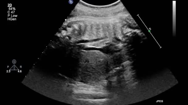 胎児心臓の超音波検査 — ストック動画
