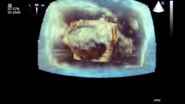 Transesophageal Ultrasound Video Mode — Stok video