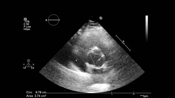 Transesofageal Ultrason Sırasında Kalbin Gri Ölçekli Görüntüsü — Stok fotoğraf