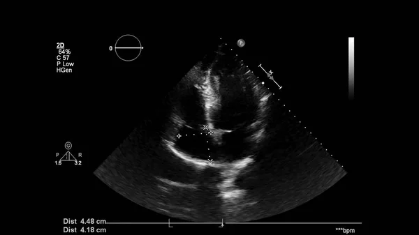 Изображение Сердца Сером Режиме Время Трансофагеального Ультразвука — стоковое фото