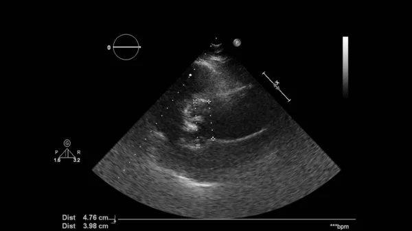 Imagem Coração Escala Cinza Durante Ultrassonografia Transesofágica — Fotografia de Stock