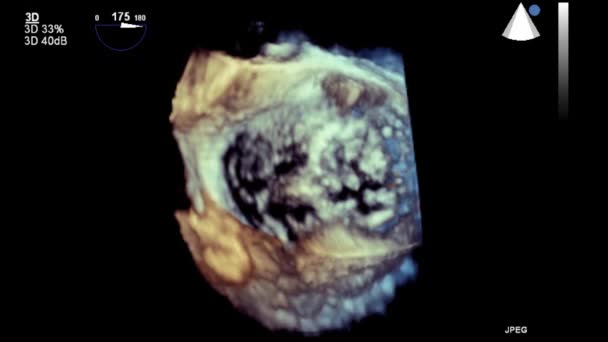 Echografie Transslokdarmonderzoek Van Het Hart — Stockvideo