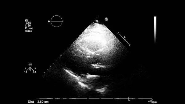 Transesofageal Ultrason Sırasında Kalbin Gri Ölçekli Görüntüsü — Stok fotoğraf