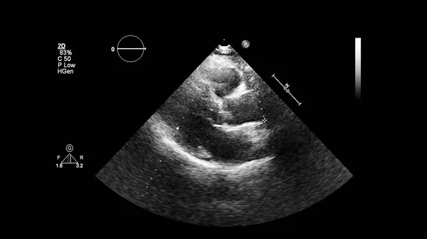 Изображение Сердца Сером Режиме Время Трансофагеального Ультразвука — стоковое фото