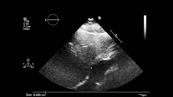 经食管超声下灰度型心脏影像学 — 图库照片