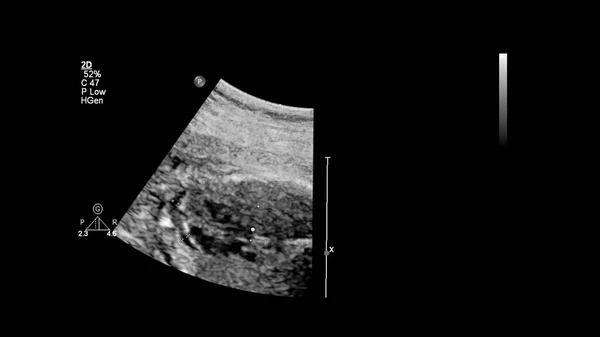 Ecografía Con Ecocardiografía Fetal —  Fotos de Stock