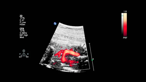 Ultraschallbild Mit Fetaler Echokardiographie — Stockfoto