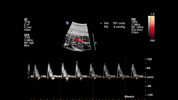 Ecografía Con Ecocardiografía Fetal — Foto de Stock