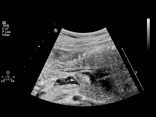 Ecografía Con Ecocardiografía Fetal —  Fotos de Stock