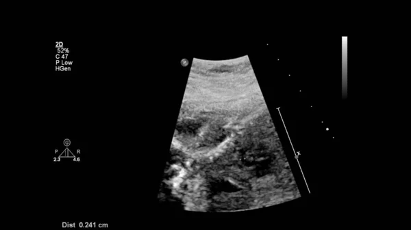 Echografie Scherm Met Foetale Echocardiografie — Stockfoto