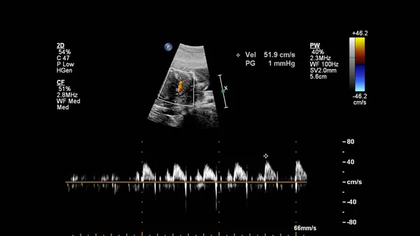 Ecografía Con Ecocardiografía Fetal —  Fotos de Stock