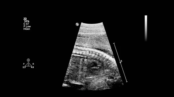 Ecrã Ultrassonográfico Com Ecocardiografia Fetal — Fotografia de Stock