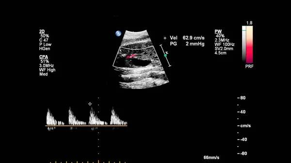 Ecografía Con Ecocardiografía Fetal —  Fotos de Stock