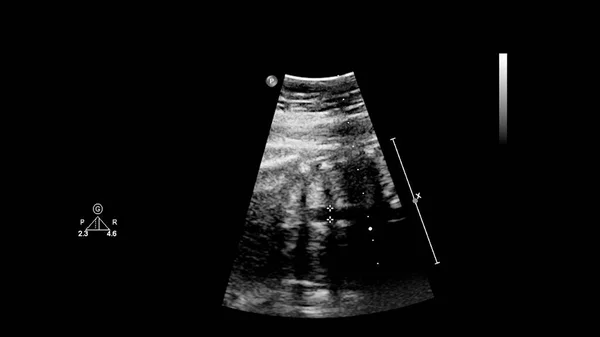 Ecran Ultrasunete Ecocardiografie Fetală — Fotografie, imagine de stoc