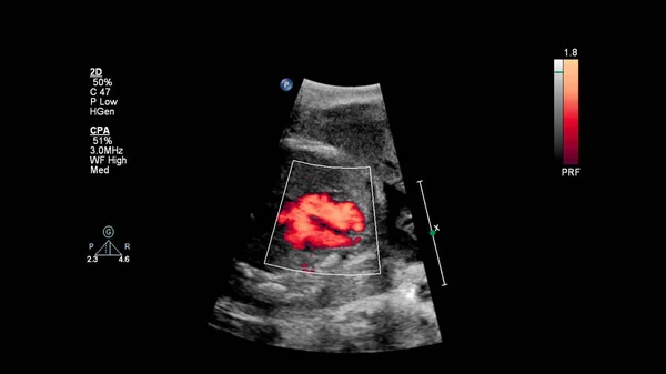 胎児心エコー検査付き超音波スクリーン ロイヤリティフリーのストック写真