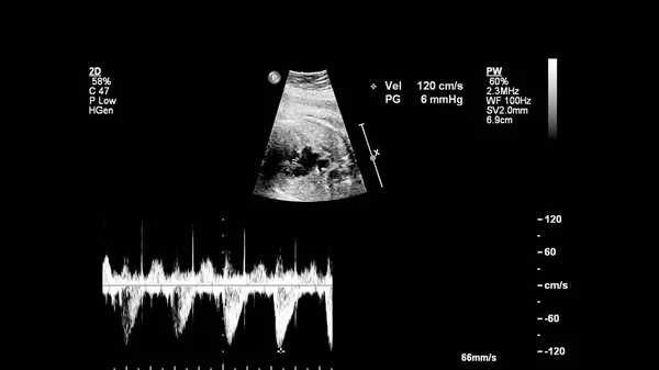 胎児心エコー検査付き超音波スクリーン ストック写真