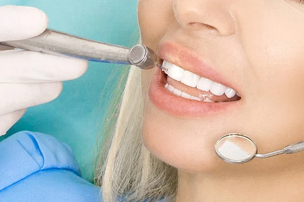 Młoda piękna kobieta z piękne białe zęby, siedząc na Fotel dentystyczny. Dentysta leczy zęby. — Zdjęcie stockowe