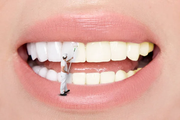 Hermosos Dientes Blanqueamiento Dental Por Dentista — Foto de Stock