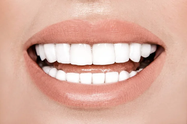 Lachende Vrouw Met Grote Tanden Witte Achtergrond Whitening Concept Tandheelkunde — Stockfoto