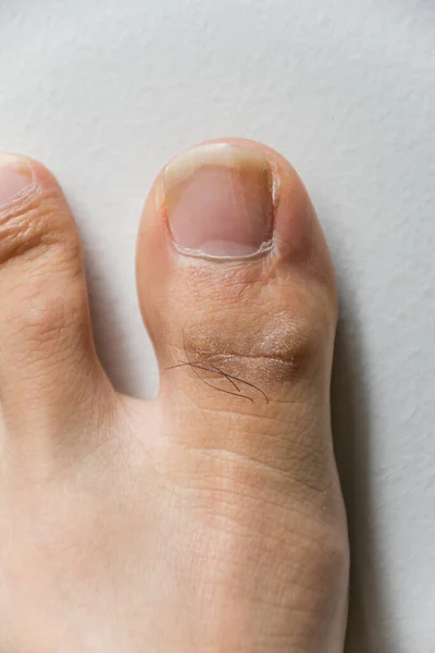 De voet en lange nagel tenen op witte betonnen achtergrond. Lange nagels en vuil kunnen schimmel veroorzaken. — Stockfoto