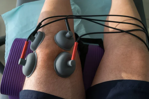 Ventosas aplicadas em um joelho em fisioterapia — Fotografia de Stock