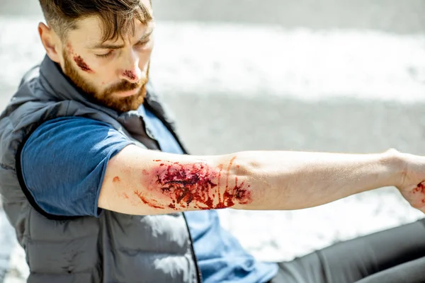 Trafik kazasından sonra yaralanan adam. — Stok fotoğraf