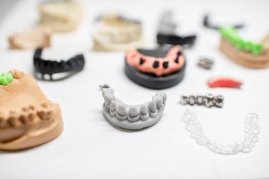 Artificial jaw models with dental implants