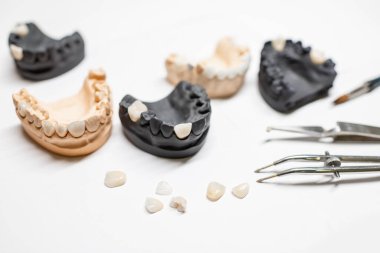 Artificial jaw models with veneers