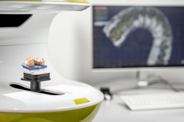Scanning jaw model on the 3rd scanner at the lab
