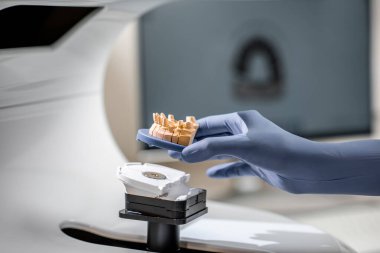 Placing jaw model into the 3d scanner