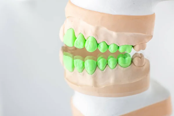 Mandíbula artificial con dientes verdes — Foto de Stock