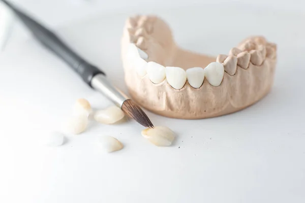 Model of artificial jaw with teeth — Stok fotoğraf