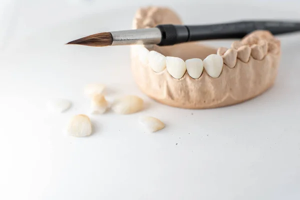 Model of artificial jaw with teeth — ストック写真