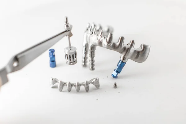 Bingkai logam untuk implan gigi — Stok Foto
