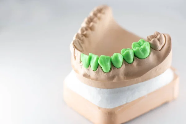 Штучна щелепа з зеленими зубами — стокове фото