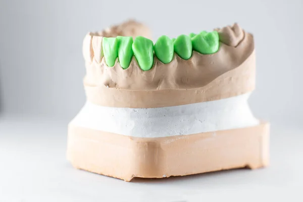 Artificial jaw with green teeth — Stok fotoğraf