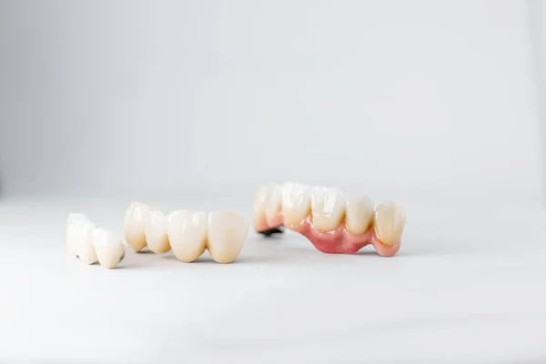 Dental crowns on the white background — Stok fotoğraf